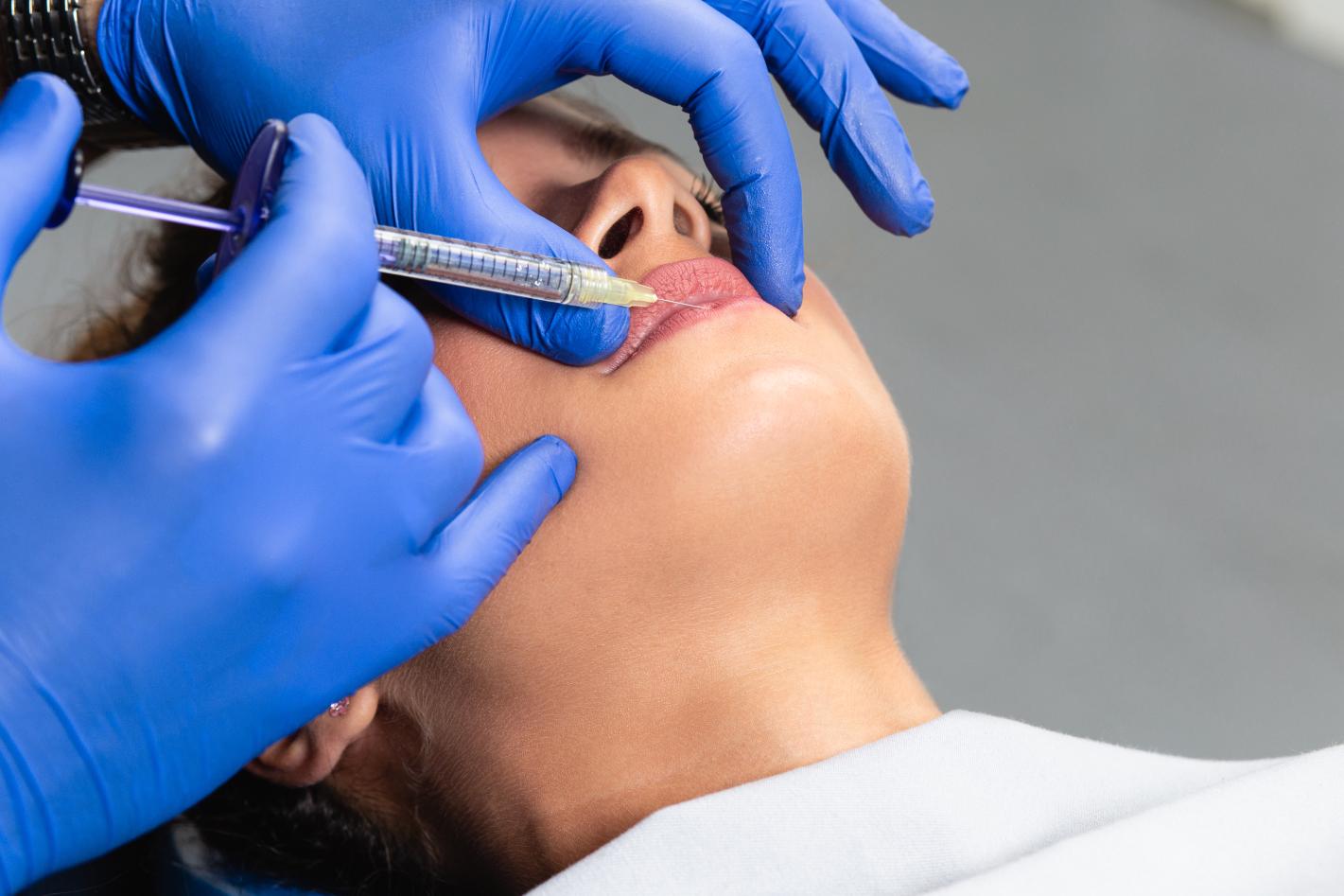 Close-up of a med spa filler procedure on a woman's lips.