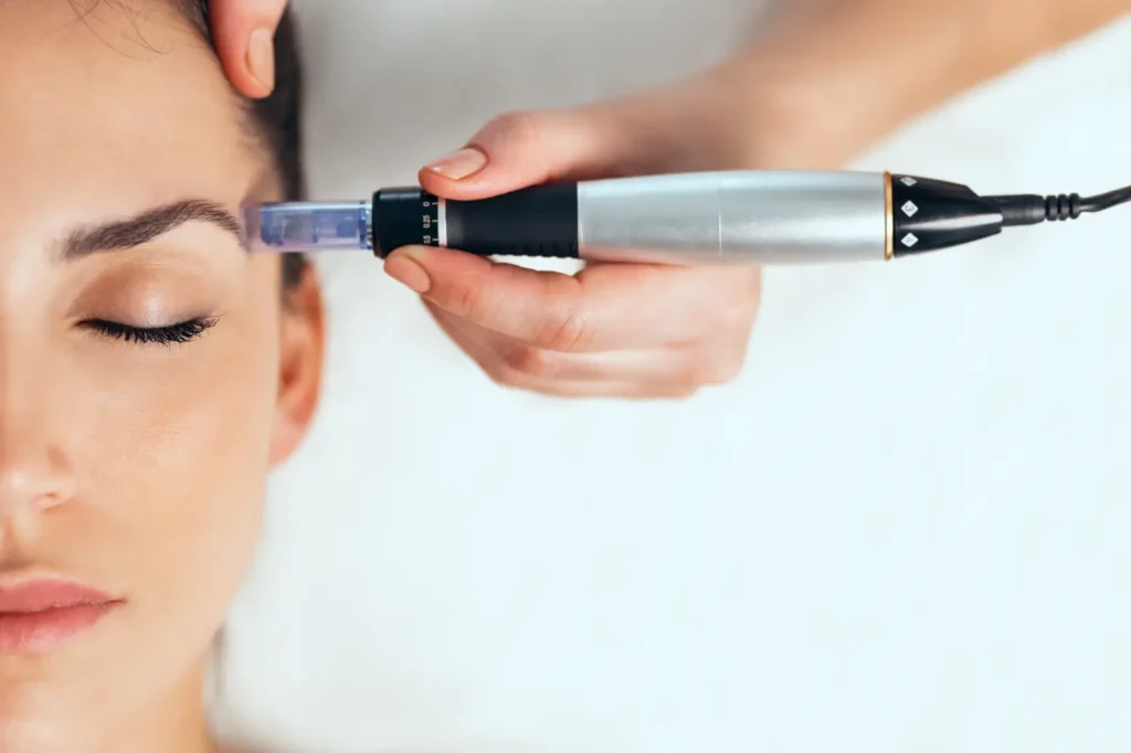 Handheld microneedling device positioned near a woman's eyebrow during a facial treatment.