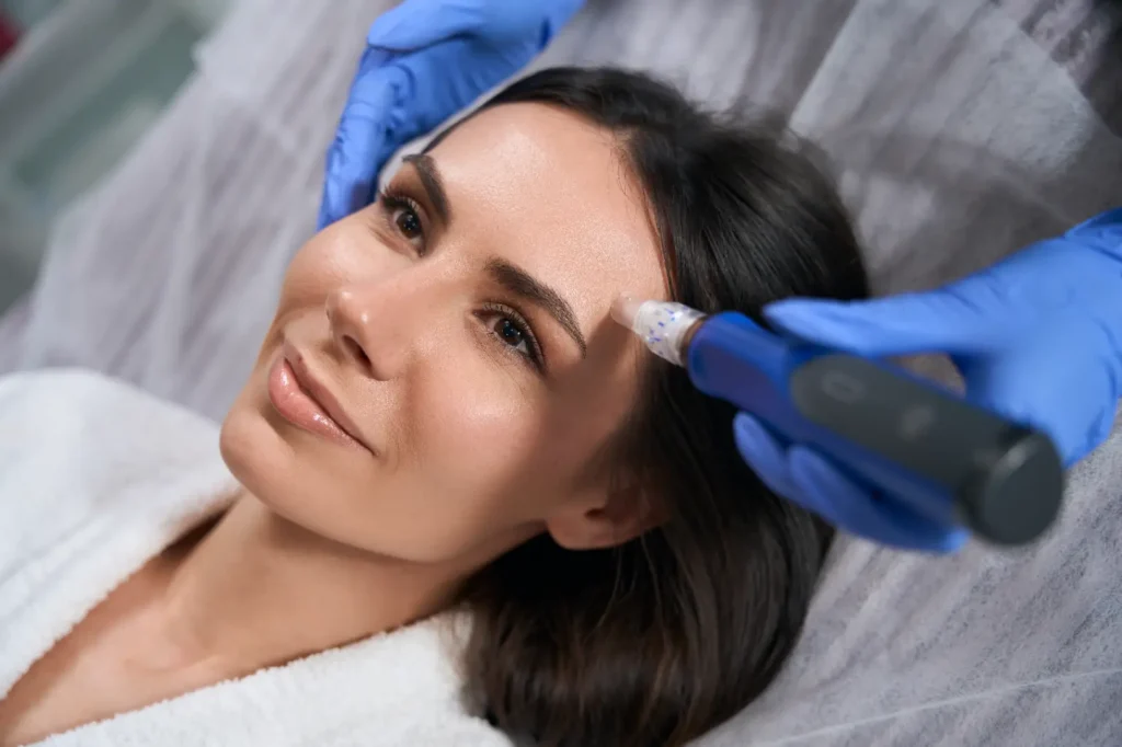 Practitioner wearing blue gloves performs a microneedling treatment on a woman's forehead with a handheld device.